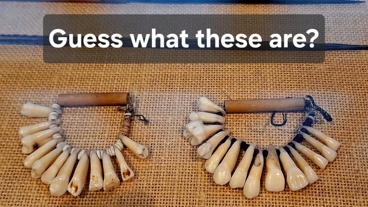 Can you guess what these are?