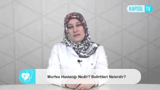 Morfea Hastalığı Nedir? Belirtileri Nelerdir?