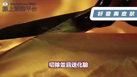 乳房管內乳突瘤，不可輕忽的疾病！！ft.整形外科&乳房外科 雙專科高瑞吟醫師 - 天天要聞
