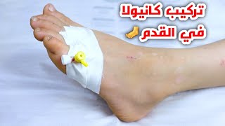 تعليم تركيب الكانيولا في القدم للمبتدأين_Teaching cannula in the foot for beginners_