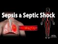 Sepsis and septic shock animation