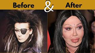 30 Hollywood Celebrities Transformed by Plastic Surgery | Then & Now