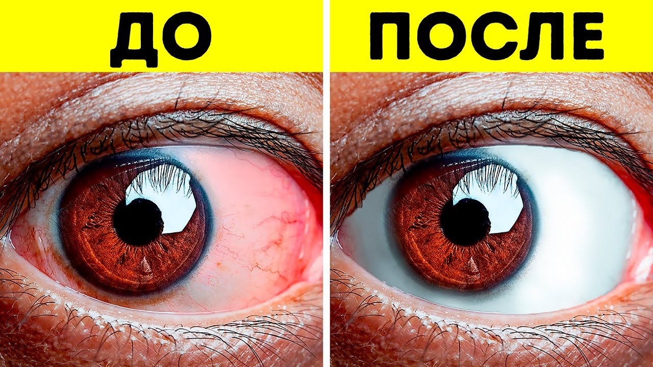Красные глаза: снимаем усталость - Полезная информация 