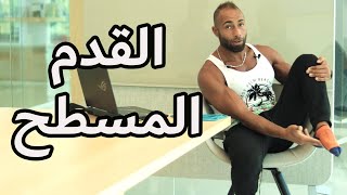 أفضل حل للقدم المسطح | FLAT FOOT