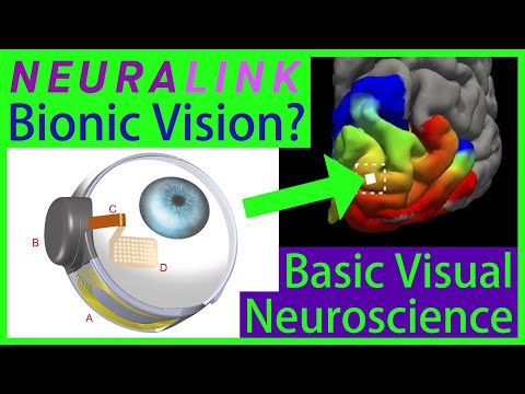 Can Neuralink Cure Blindness? Superhuman Vision? [Brain Implant vs. Retinal Implant]