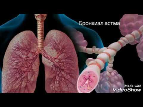 Video: Astma: Gln27Glu I Arg16Gly Polimorfizmi Gena Beta2-adrenergičkih Receptora Kao Faktori Rizika