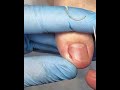 Gentle Toenail Trim | Relaxing Foot Care Routine  #fypシ゚viralシ #toenailcare #hygieneservice