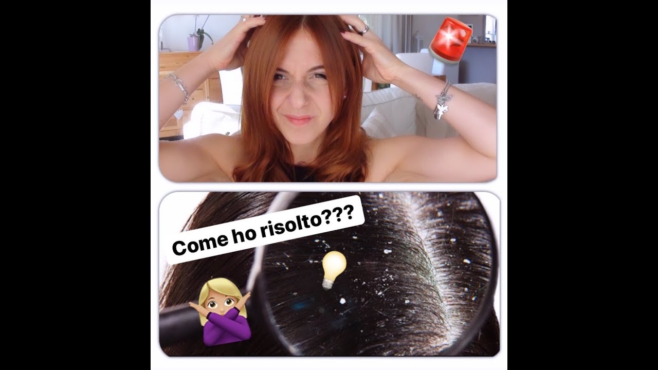 Addio desquamazione!!