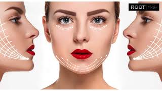 PDO Threads for Jowls in Flower Mound, TX: A Non-Invasive Solution