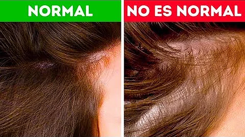 ¿Por qué tengo el pelo tan débil?