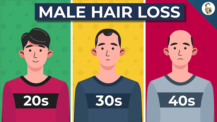 Going Bald? This Could Be Why... - DayDayNews