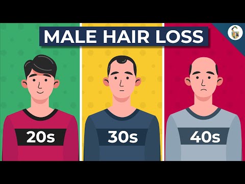 Video: 10 Mythes Over Mannelijke Alopecia