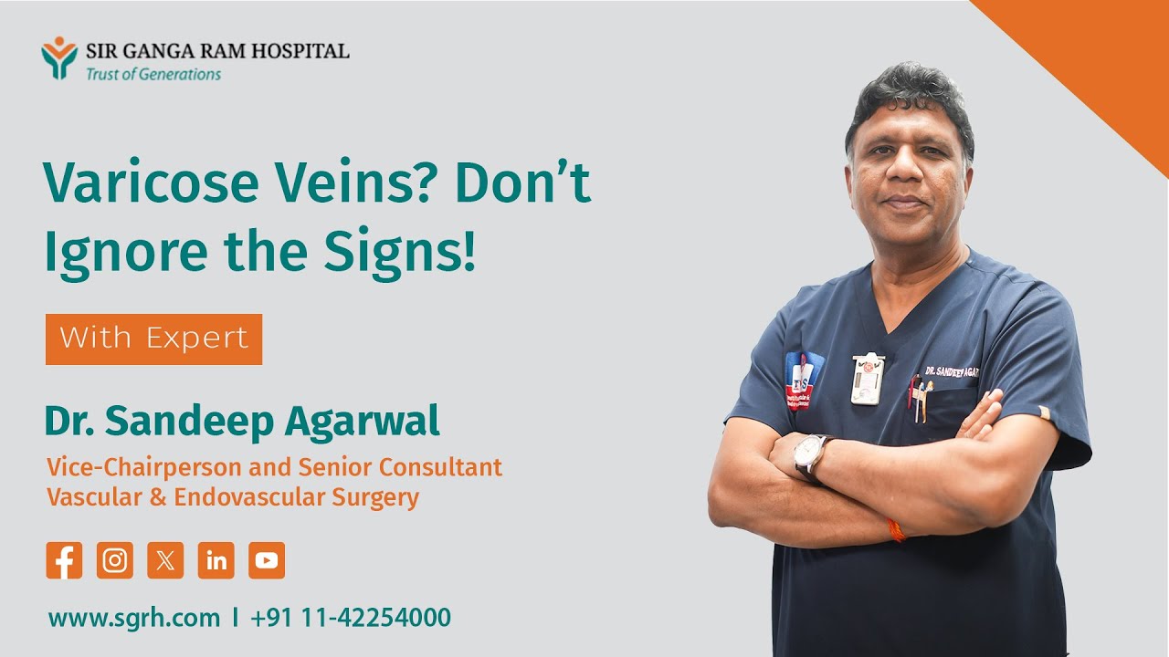 Varicose Veins: Causes, Symptoms & Latest Treatments | Sir Ganga Ram Hospital