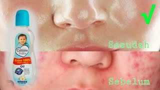 Lakukan Tiap Malam, Wajah Jadi Halus Transparan Dan Bening Seperti Kaca