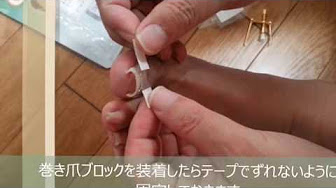 巻き爪ブロック19