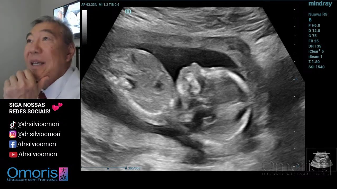 revelação 16 semanas