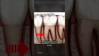 Soğuk Şeyler Yediğimizde Dişlerimiz Neden Sızlar?