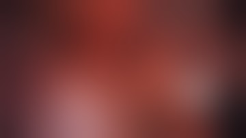 Asvide: Superior segmentectomy of left lower lobe