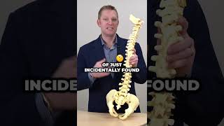 Does Scoliosis Cause Pain? Scoliosis Explained Causes Symptoms And Treatment