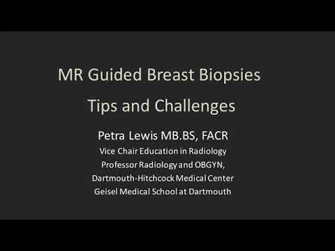MRI guided breast biopsies - tips and challenges - YouTube