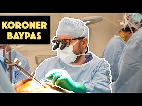 Koroner Baypas Ameliyatı | Açık Kalp Ameliyatı | DrYerebakan