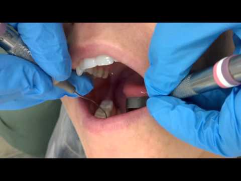 Wideo: Z jakich luster korzystają dentyści?