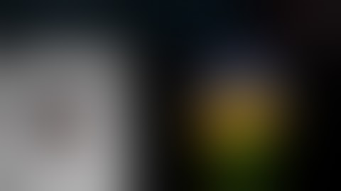 【#78】Uniportal VATS rt. S1 segmentectomy with air insufflation