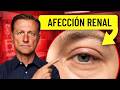 18 señales visibles de enfermedad renal que no debes ignorar