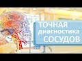 Исследование сосудов. 🔍 15 минутное исследование сосудов может спасти от инсульта и инфаркта.  МГУ