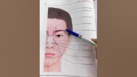 Học tiêm Filler & botox:  Biến chứng mạch máu khi tiêm filler thái dương