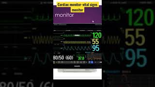 Cardiac monitor-vital signs monitor nicu neonatal neonatology pulseoximeter