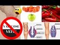 ❤Natural  Home Remedies For Varicose Veins ❤