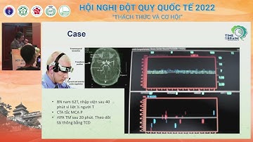 Hội nghị đột quỵ quốc tế 2022   Vai trò và thách thức của thuốc tiêu huyết khối trong kỷ nguyên LHK
