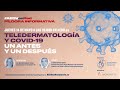 Píldora Informativa 'Teledermatología y COVID-19. Un antes y un después' por el Dr. David Moreno