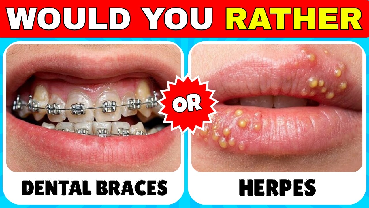 🔥 Would You Rather...? 😨 The 60 Most Extreme Choices You’ll EVER Face!