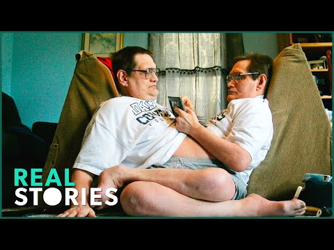 Video: Lever de ældste sammenføjede tvillinger stadig?