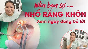 Cận cảnh nhổ răng khôn mọc kẹt chỉ trong vài phút tại Nha Khoa Italiano Thái Nguyên