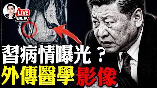 老江紀念會,宋祖英怎麼沒來?習近平曾幫六四學生偷渡?這真的假的,那他現在怎麼變成這樣?出入境收緊,國內傳排隊審查,國外網友:護照要回國更換;杭州酒局事件;習醫學影像外傳?|大宇拍案驚奇 live!