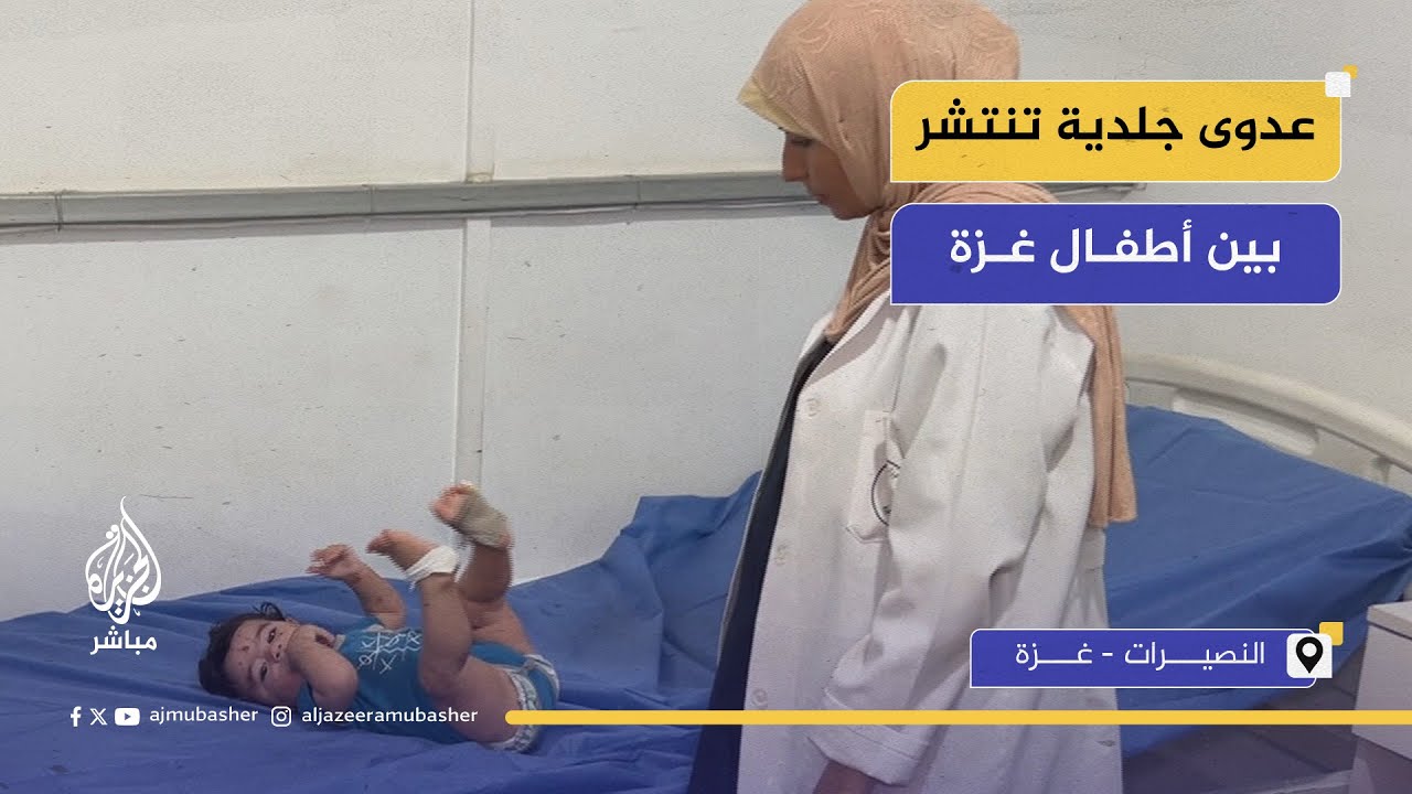مع استمرار الحرب والحصار.. عدوى جلدية تنتشر بين أطفال غزة