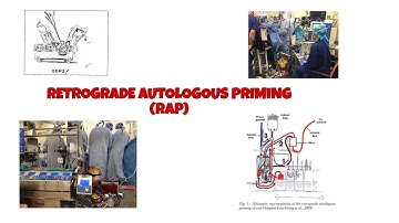 RETROGRADE AUTOLOGOUS PRIMING (RAP) blood conservation technique tamil