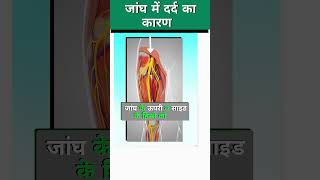 जांघ में दर्द का कारण | जांघ में दर्द क्यों होता है | JANGH ME DARD | #Meralgiaparesthetica