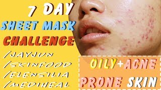 7 SHEET MASK CHALLENGE OILY+ACNE PRONE SKIN | WEEK OF SHEET MASKS EP.1 - YouTube