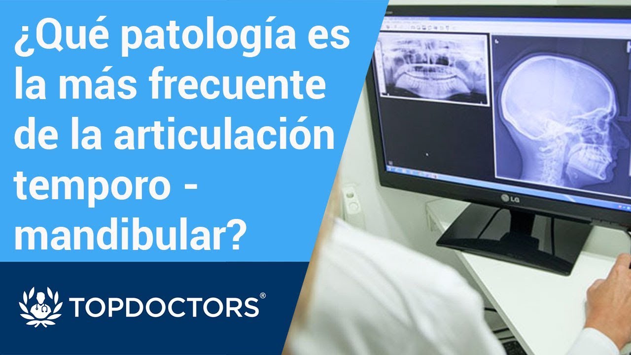 ¿Cuál es la patología más frecuente de la articulación temporomandibular? top movies on netflix