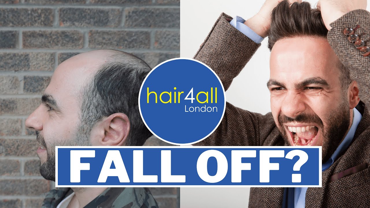 Will It Fall Off? | Hair System | Non-Surgical Hair Replacement System for Men/Women | UK/USA/INTL