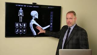 Spine Whiplash  Spinal Injuries in Accidents