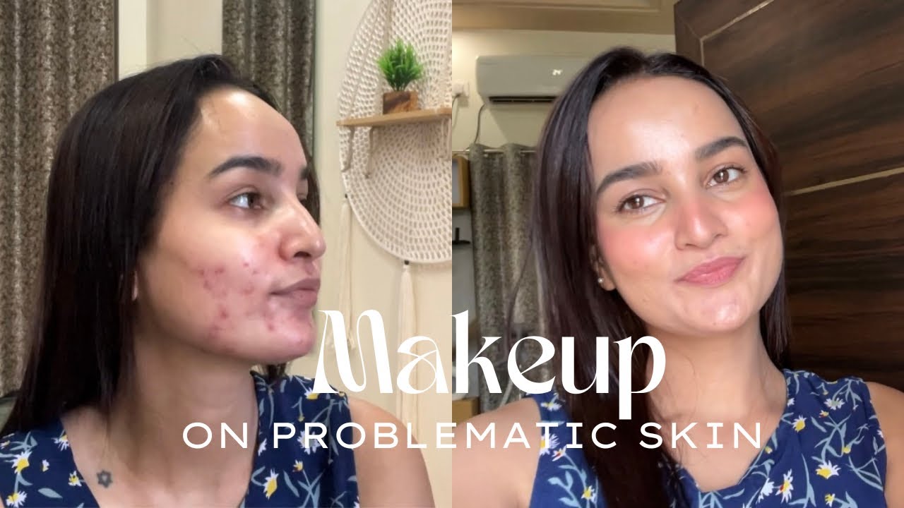 Макияж для проблемной кожи (третиноин, очищение, следы от акне) | Моя честная рутина/борьба 💔