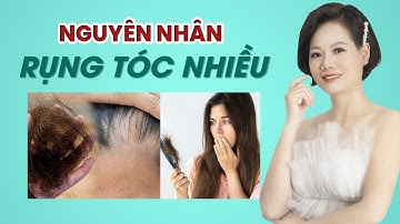 Top 5 Nguyên Nhân Rụng Tóc Phổ Biến,Bạn Có Biết?| Linh Nguyễn Official
