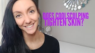 Does coolsculpting tighten skin