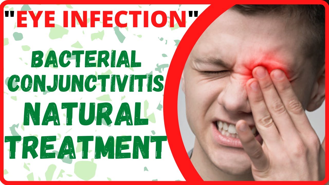 Bacterial Conjunctivitis Bacterial Eye Infection Natural Treatment