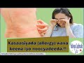 MAXAA KEENA XASAASIYADA ALLERGY IMMISA NOOC BAY UQAYBSANTAA Mawduuc Muhiima MAXAA KEENA XASAASIYADA ALLERGY IMMISA NOOC BAY UQAYBSANTAA Mawduuc Muhiima